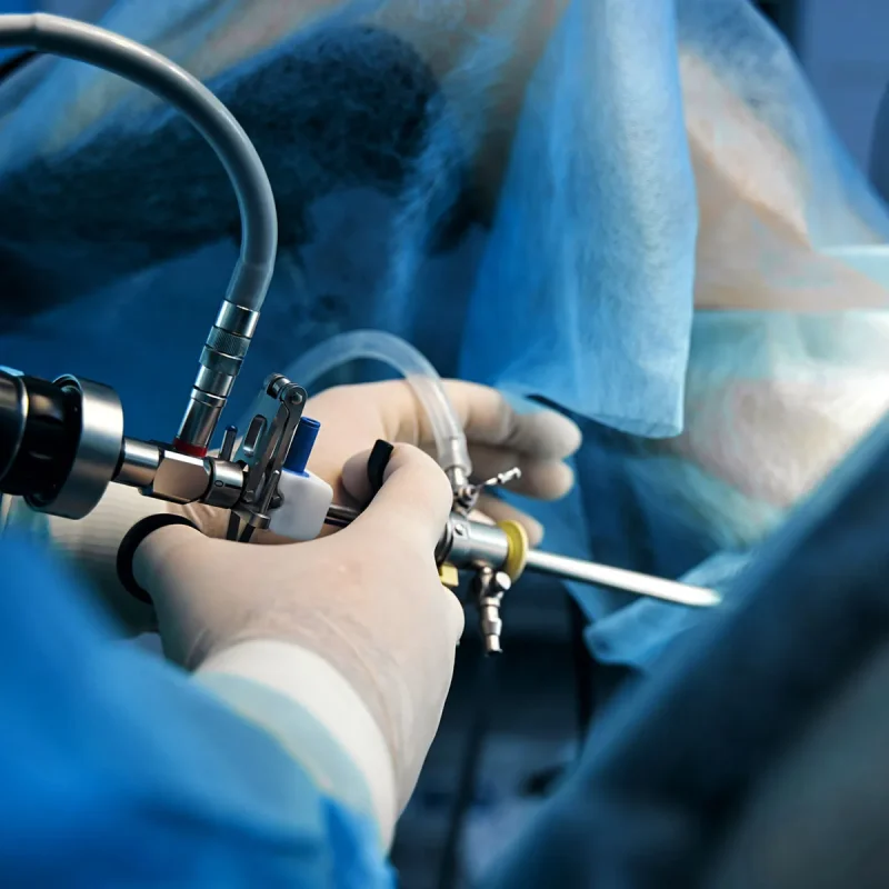 1800x1200_hysteroscopy_bigbead