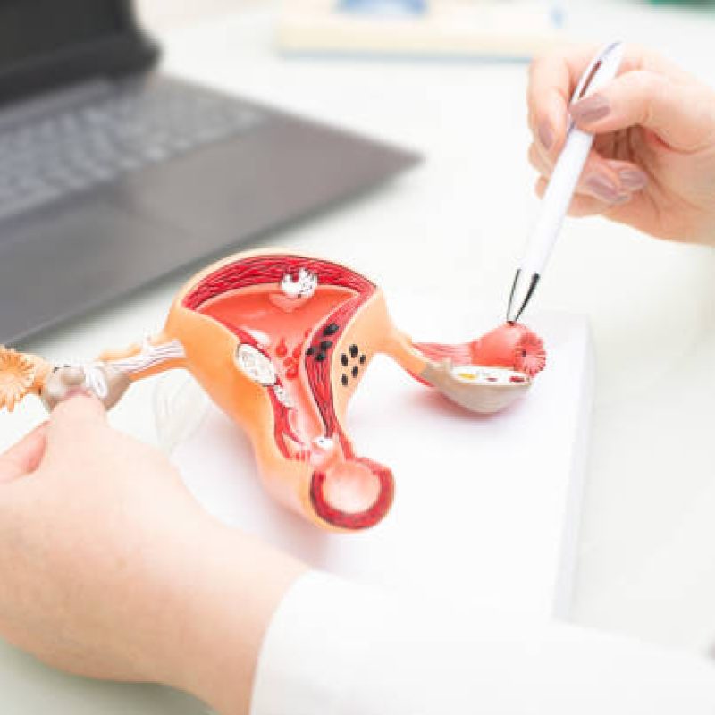 Gynecologist showing uterine structure on a uterus model. Uterus model on gynecologist's desk close-up